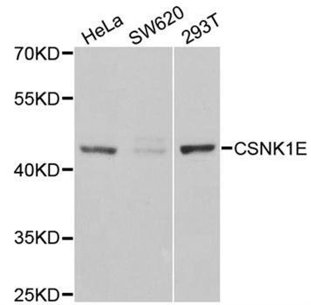 Western blot analysis of extracts of various cell lines using CSNK1E antibody