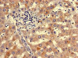 Immunohistochemistry of paraffin-embedded human liver tissue using CSB-PA750379LA01HU at dilution of 1:100