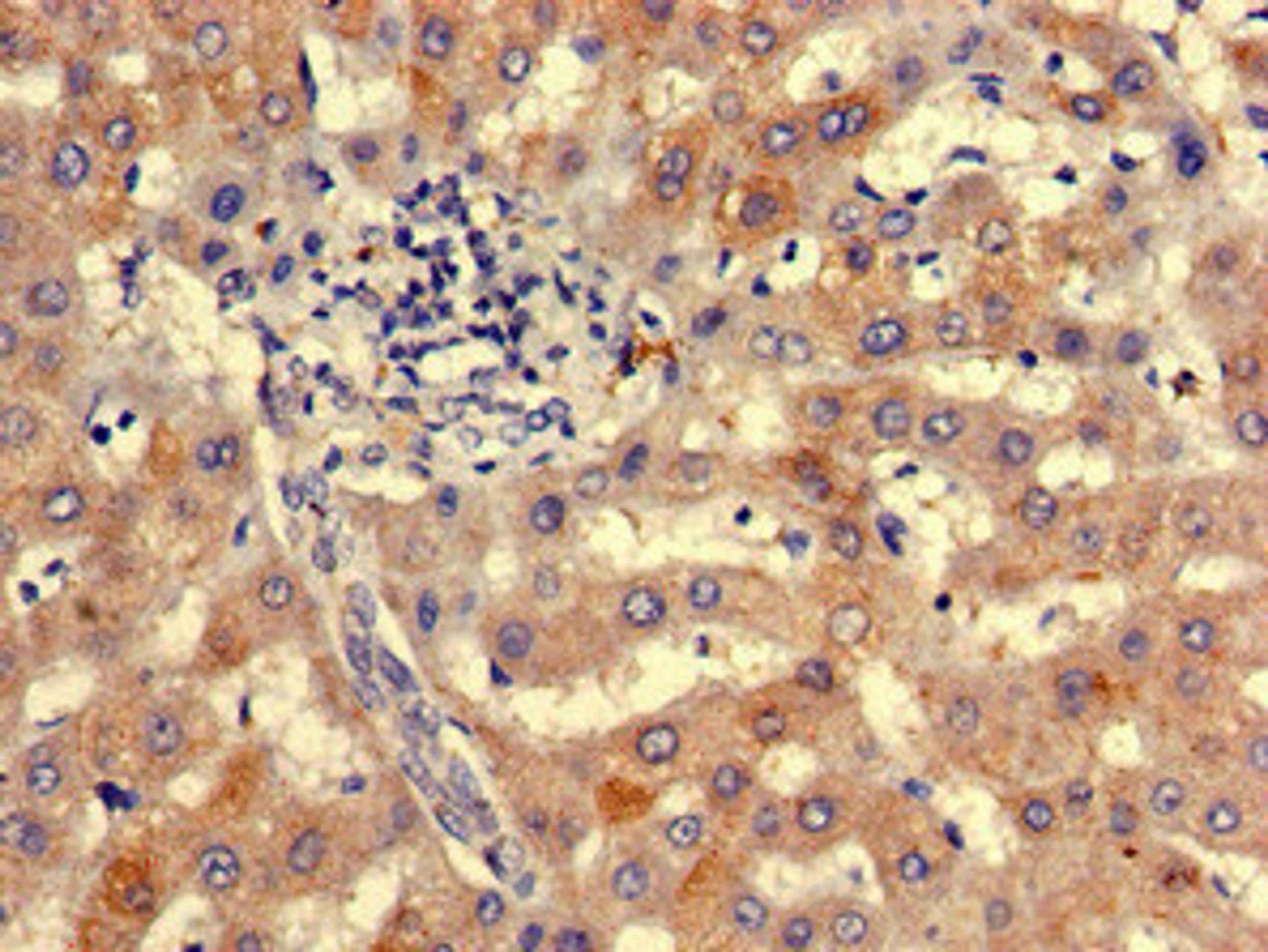 Immunohistochemistry of paraffin-embedded human liver tissue using CSB-PA750379LA01HU at dilution of 1:100