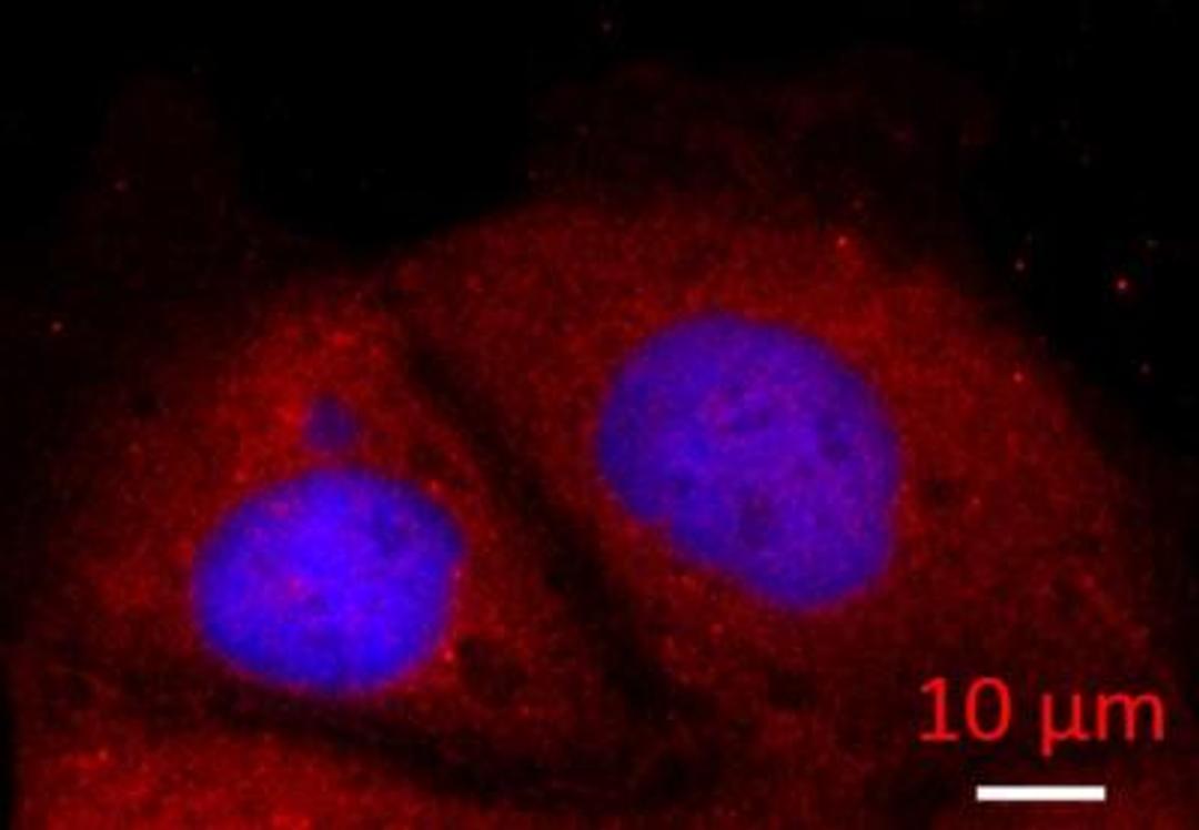 Immunocytochemistry/Immunofluorescence: Alpha Fodrin Antibody [NBP1-53093] - analysis of Alpha Fodrin in methanol-aceton fixed Caco-2 cells using anti-Alpha Fodrin antibody. Image from verified customer review.