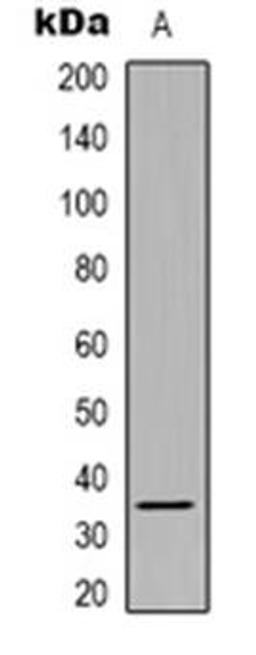 Western blot analysis of SRSF8 expression in Hela (Lane 1) whole cell lysates using SRSF8 antibody