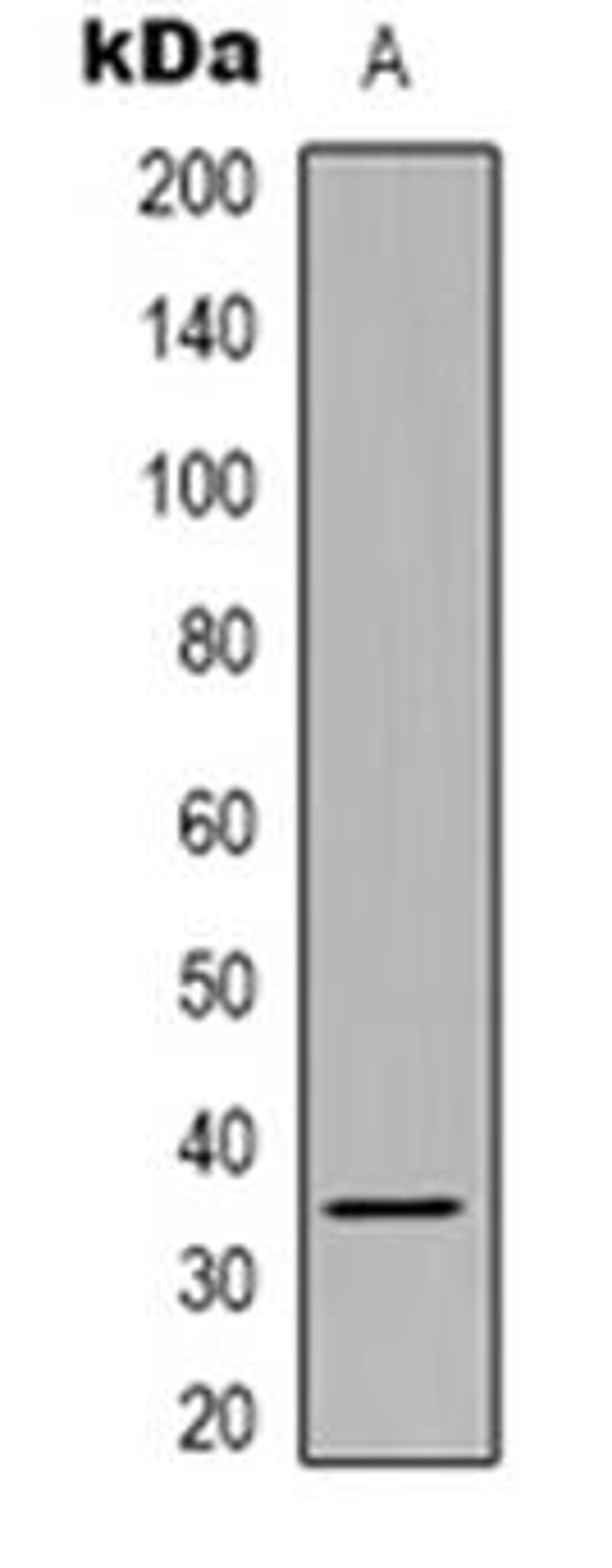 Western blot analysis of SRSF8 expression in Hela (Lane 1) whole cell lysates using SRSF8 antibody