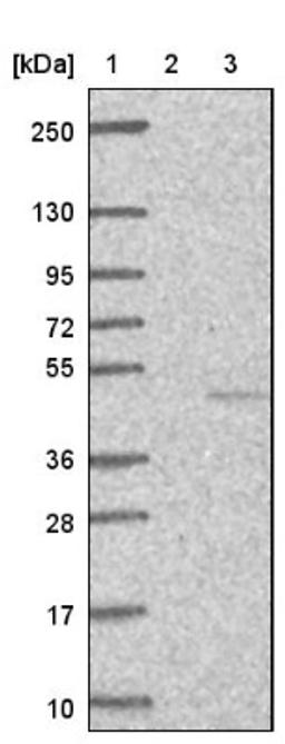 Western Blot: Pejvakin Antibody [NBP1-87298] - Lane 1: Marker [kDa] 250, 130, 95, 72, 55, 36, 28, 17, 10<br/>Lane 2: Negative control (vector only transfected HEK293T lysate)<br/>Lane 3: Over-expression lysate (Co-expressed with a C-terminal myc-DDK tag (~3.1 kDa) in mammalian HEK293T cells, LY421031)