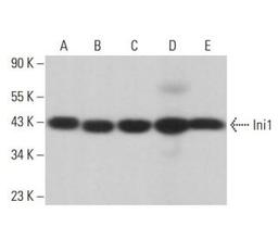 Western blot analysis of Ini1 expression