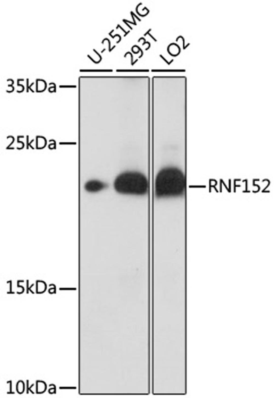 Western blot - RNF152 antibody (A16608)