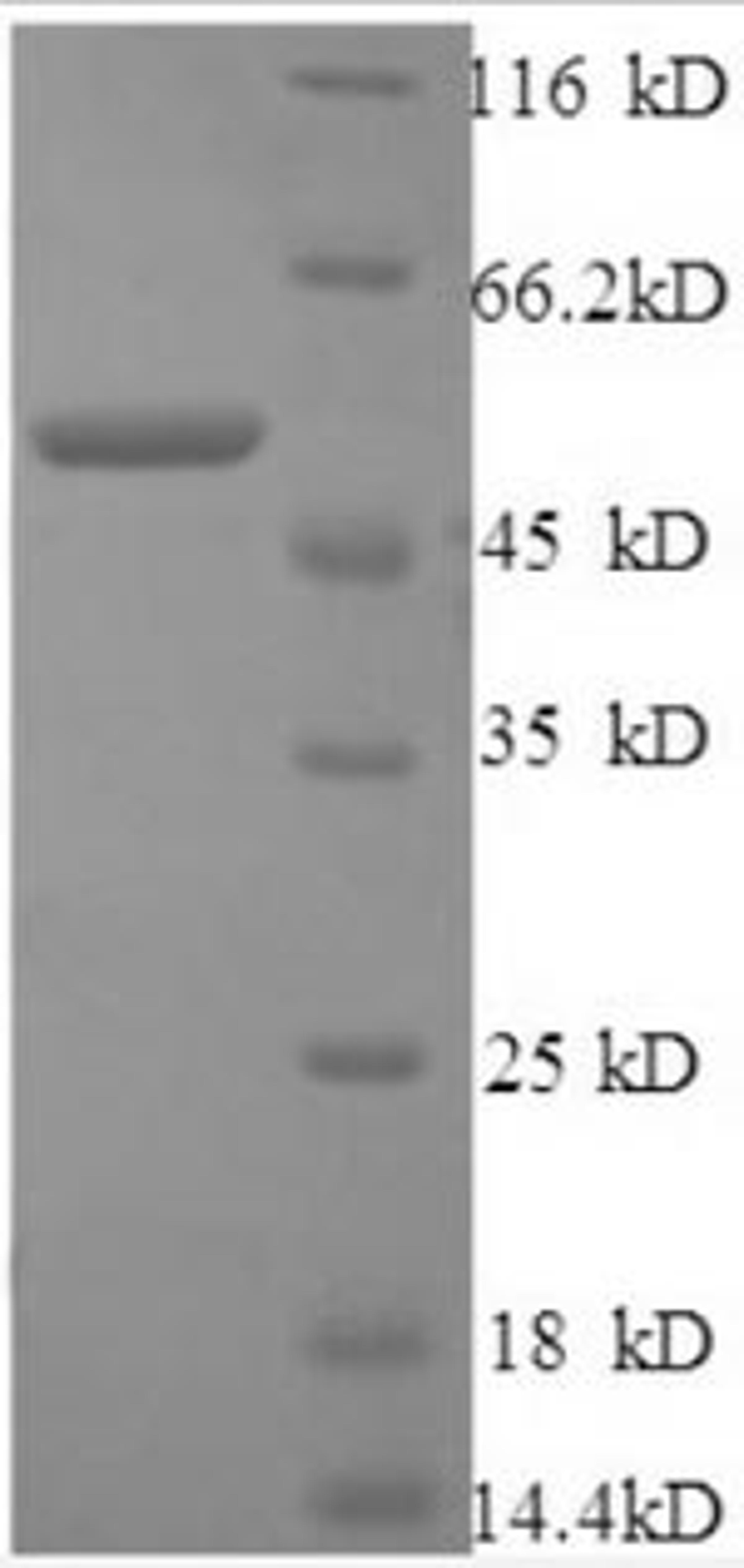 (Tris-Glycine gel) Discontinuous SDS-PAGE (reduced) with 5% enrichment gel and 15% separation gel.
