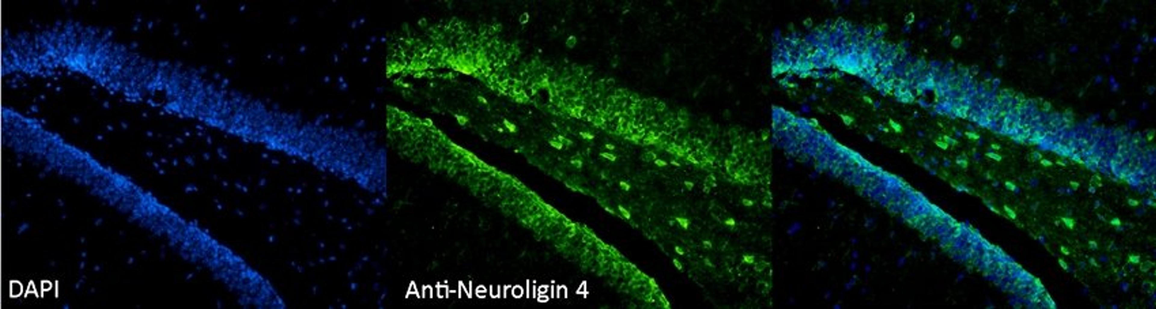 Immunohistochemical staining of mouse Dentate Gyrus tissue using Neuroligin 4 antibody