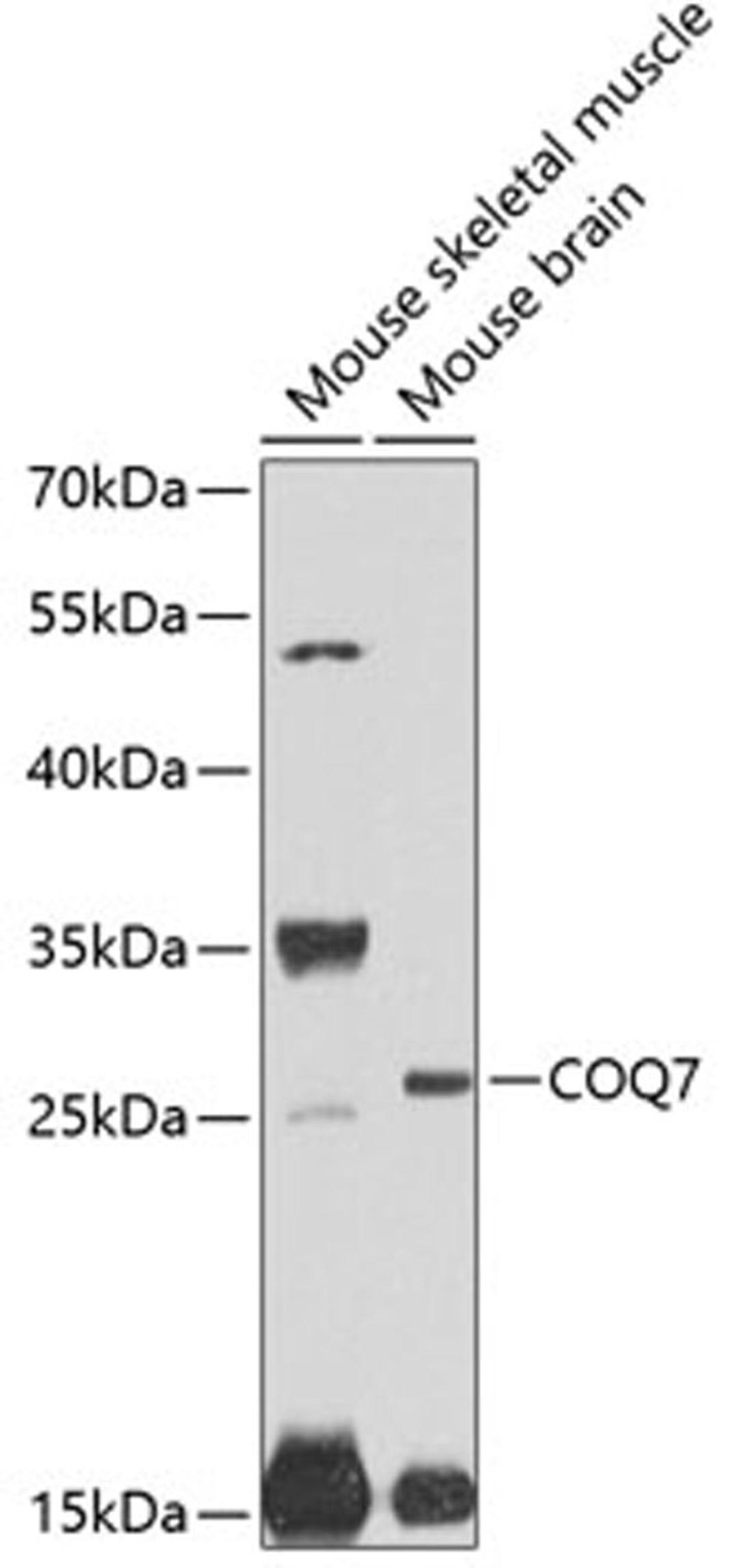 Western blot - COQ7 antibody (A7768)