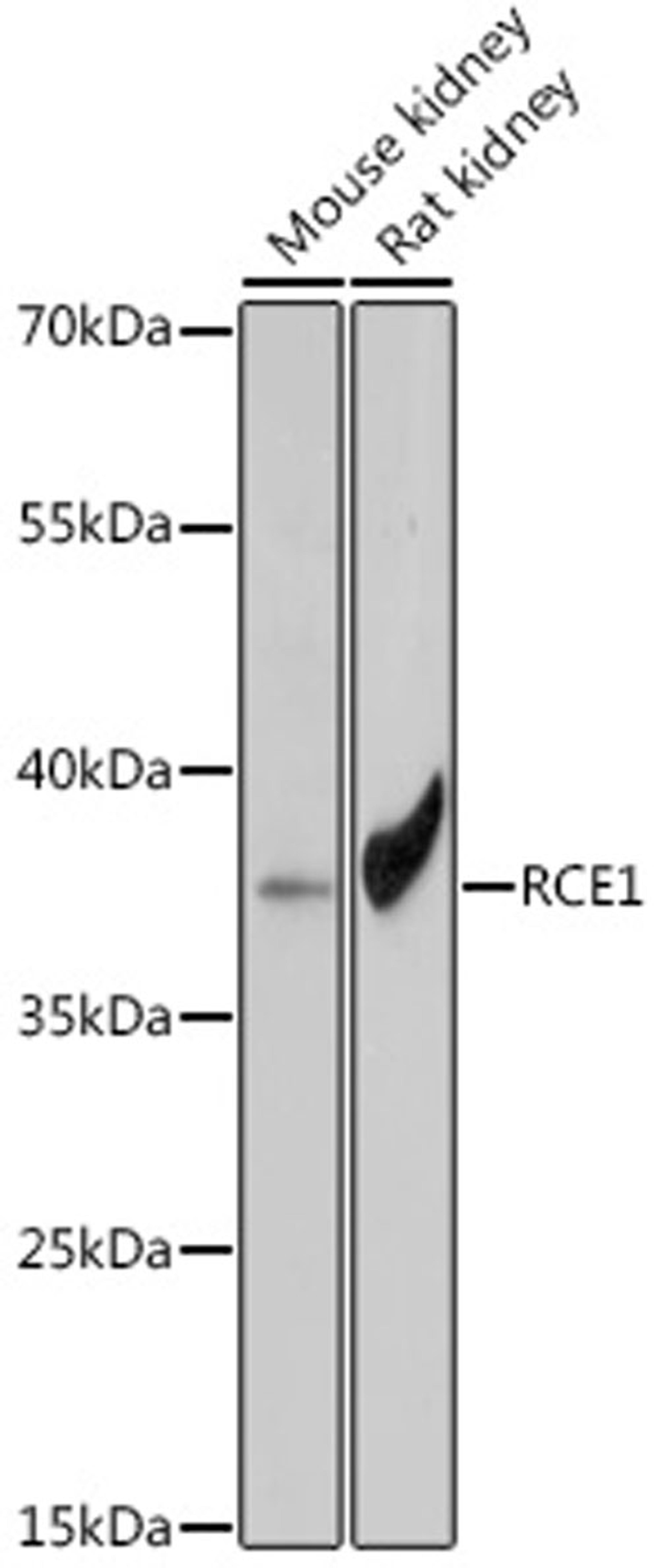 Western blot - RCE1 antibody (A18414)