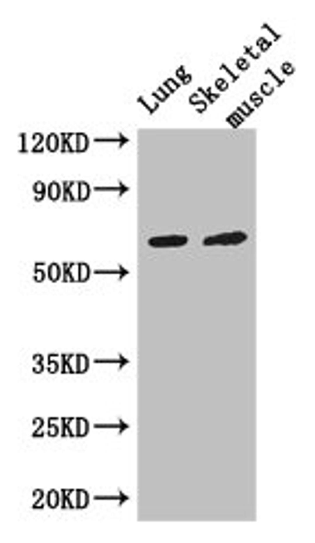 Western Blot. Positive WB detected in: Mouse lung tissue, Mouse skeletal muscle tissue. All lanes: PAK3 antibody at 3ug/ml. Secondary. Goat polyclonal to rabbit IgG at 1/50000 dilution. Predicted band size: 63, 61, 65 kDa. Observed band size: 63 kDa. 