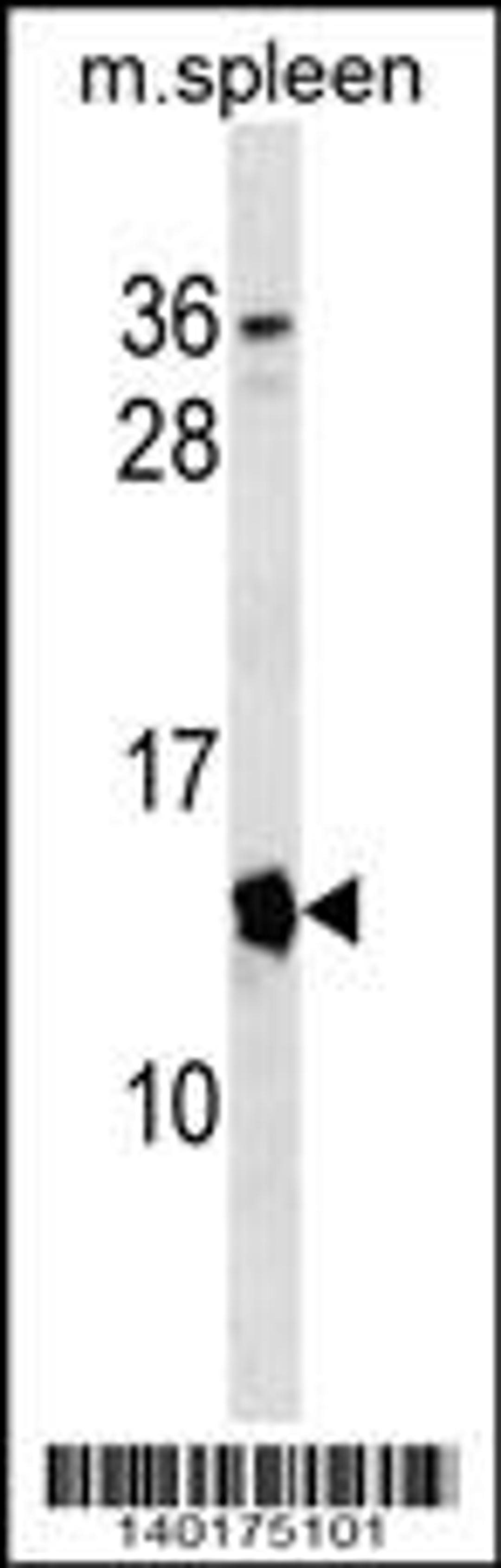 Western blot analysis in mouse spleen tissue lysates (35ug/lane).