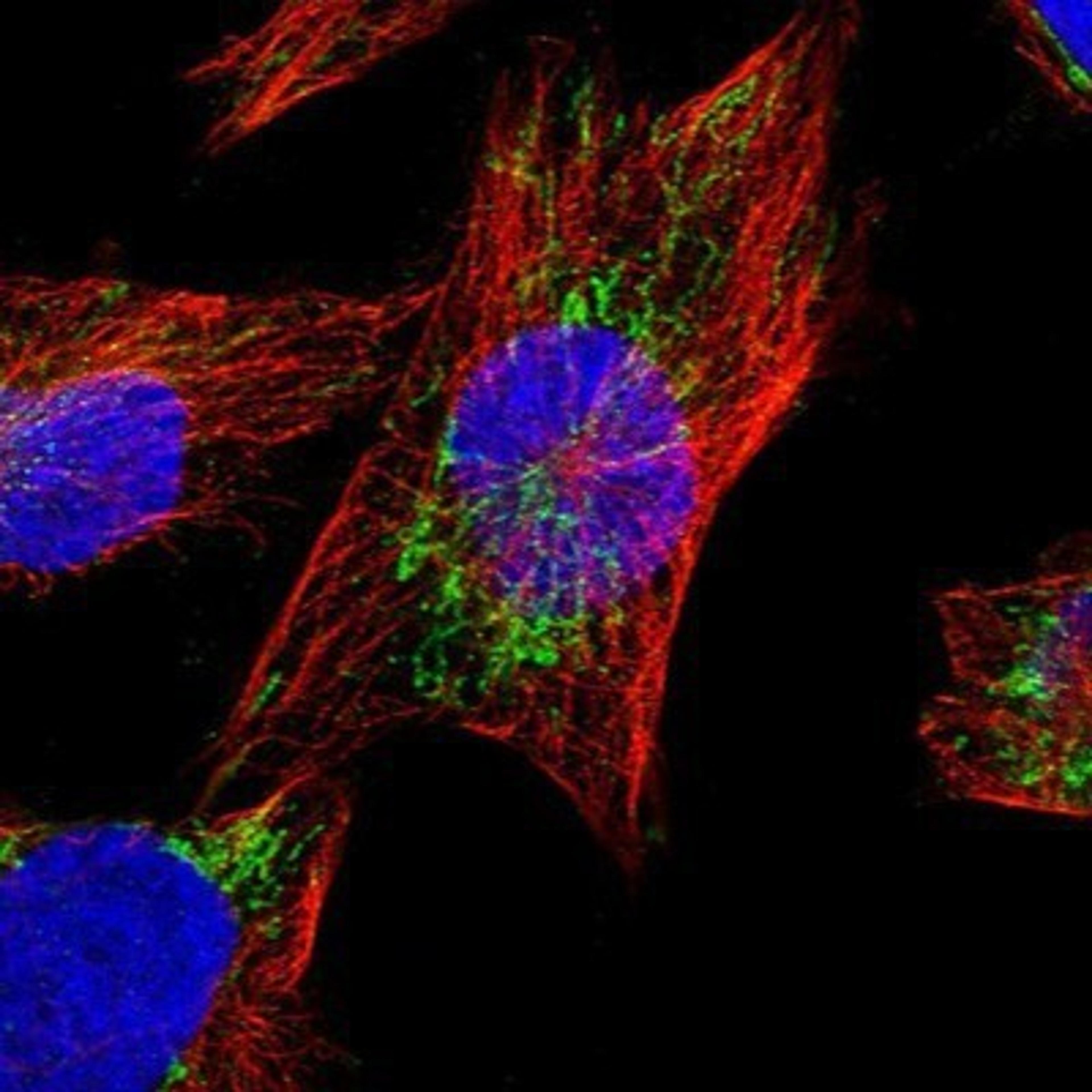 Immunocytochemistry/Immunofluorescence: AASS Antibody [NBP1-82832] - Staining of human cell line U-251MG shows positivity in mitochondria.