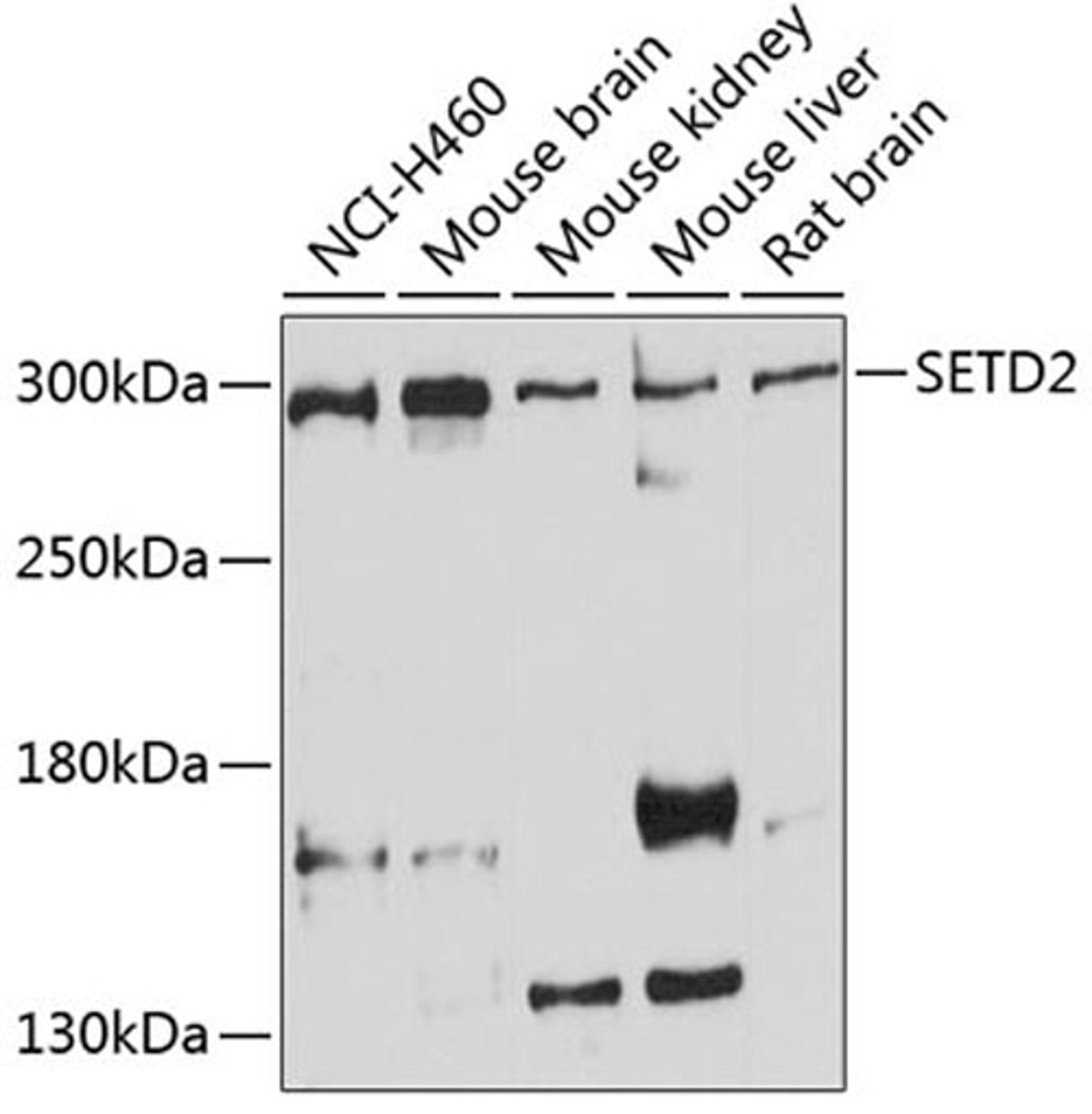 Western blot - SETD2 antibody (A3194)