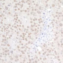 Detection of mouse p66alpha by immunohistochemistry.