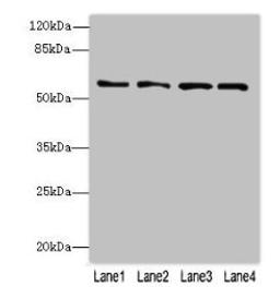 Western blot. All lanes: FLAD1 antibody at 4µg/ml. Lane 1: K562 whole cell lysate. Lane 2: HepG2 whole cell lysate. Lane 3: MDA-MB-231 whole cell lysate. Lane 4: Hela whole cell lysate. Secondary. Goat polyclonal to rabbit IgG at 1/10000 dilution. Predicted band size: 66, 55, 50, 33, 37 kDa. Observed band size: 66 kDa