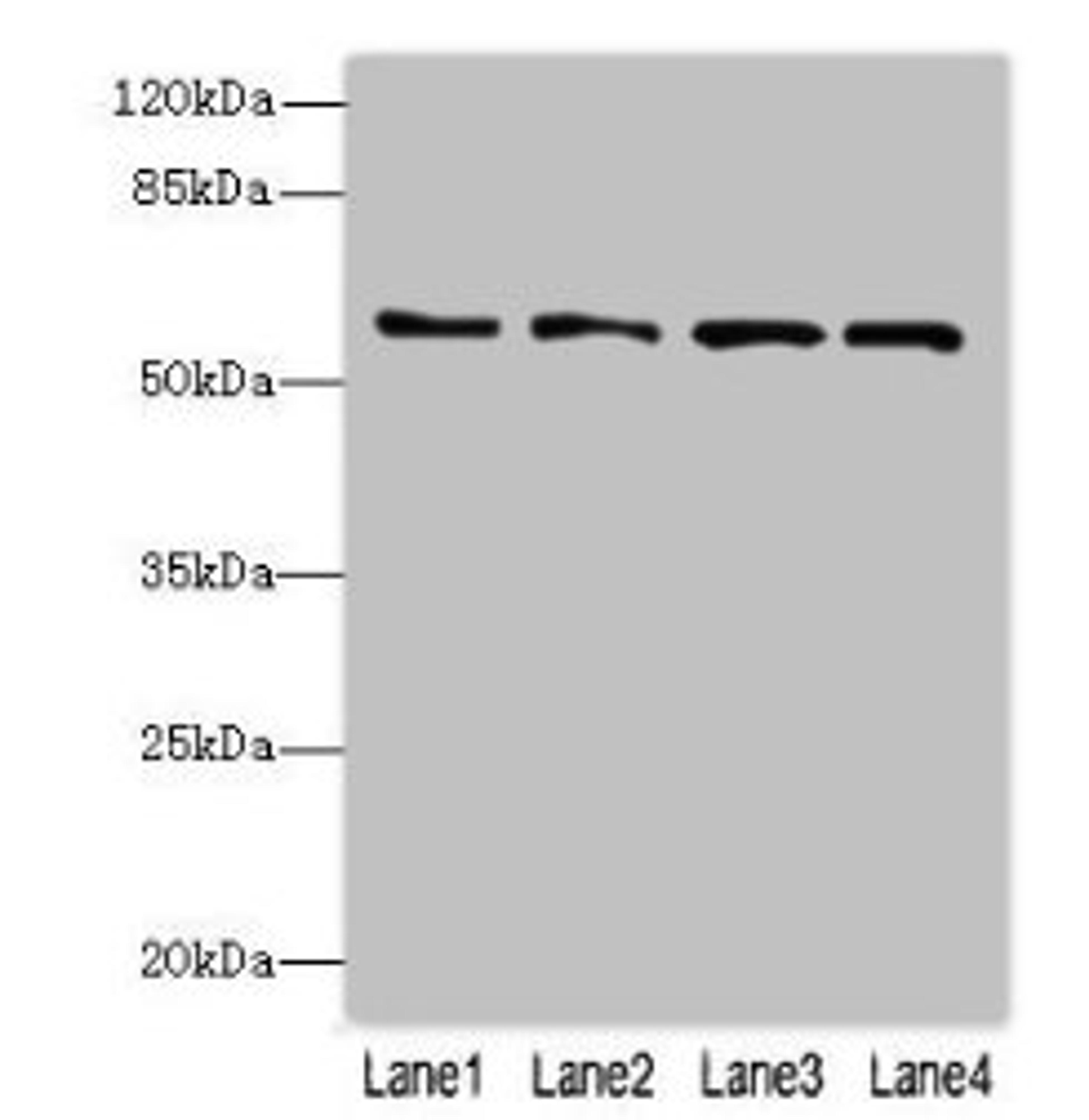 Western blot. All lanes: FLAD1 antibody at 4µg/ml. Lane 1: K562 whole cell lysate. Lane 2: HepG2 whole cell lysate. Lane 3: MDA-MB-231 whole cell lysate. Lane 4: Hela whole cell lysate. Secondary. Goat polyclonal to rabbit IgG at 1/10000 dilution. Predicted band size: 66, 55, 50, 33, 37 kDa. Observed band size: 66 kDa