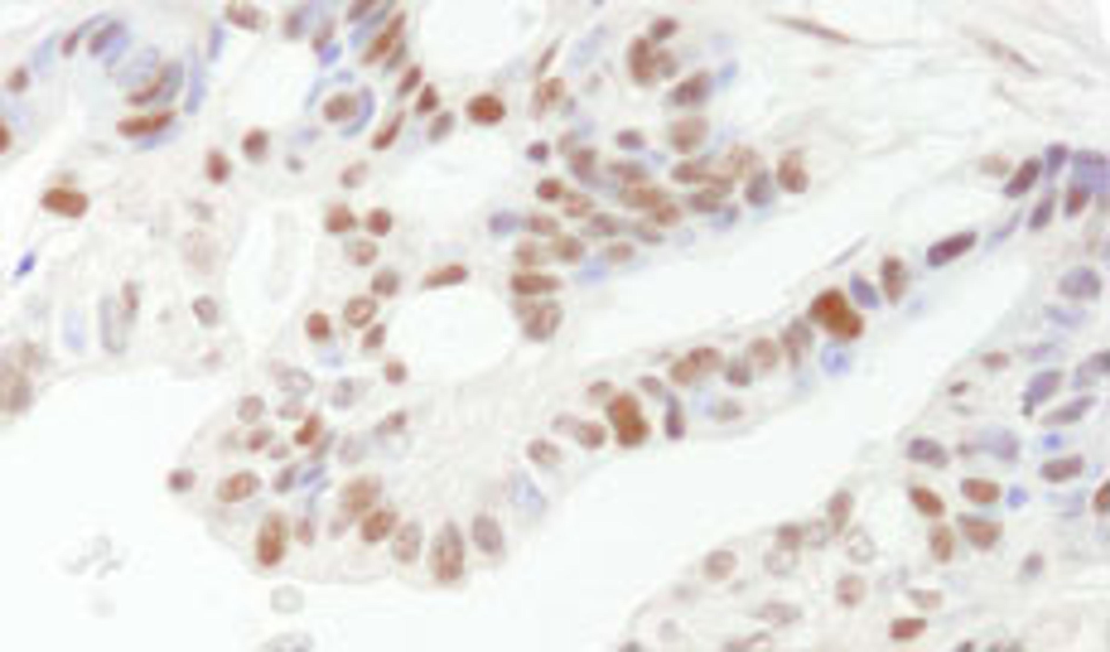 Detection of human DFF45/DFFA by immunohistochemistry.