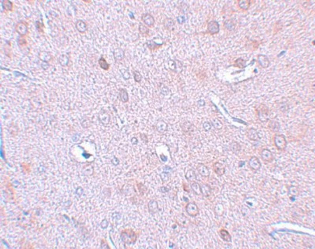 Immunohistochemistry-Paraffin: DCLK1 Antibody [NBP1-77127] - Rat brain tissue with DCAMLK1 antibody at 2.5 ug/mL.