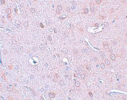 Immunohistochemistry-Paraffin: DCLK1 Antibody [NBP1-77127] - Rat brain tissue with DCAMLK1 antibody at 2.5 ug/mL.