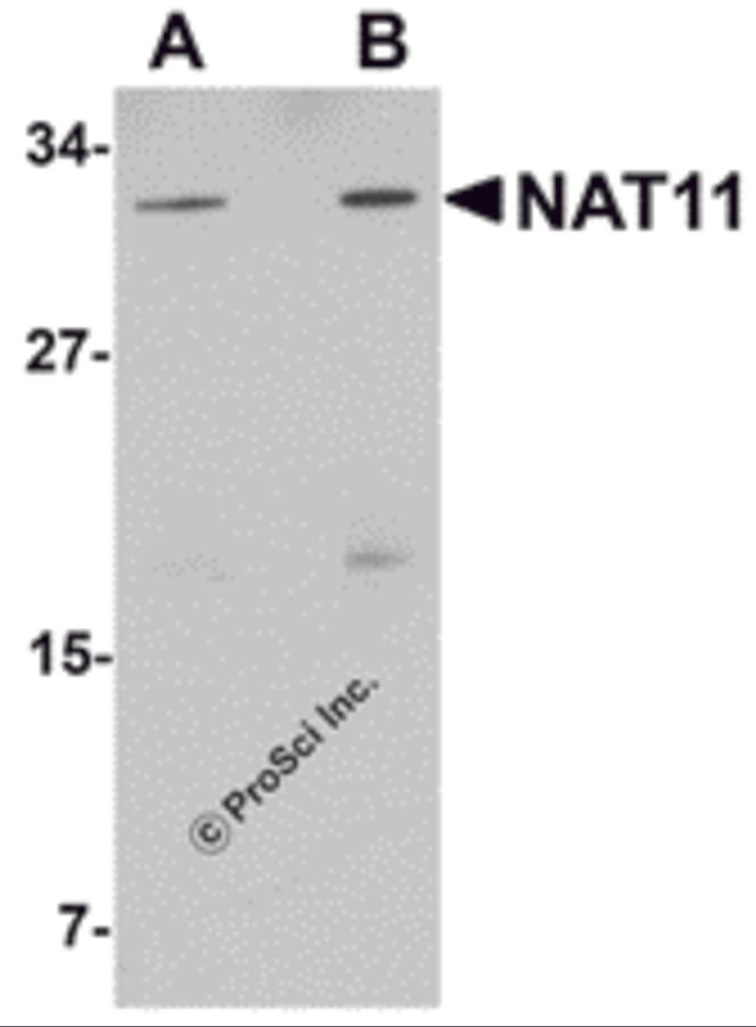 Western blot analysis of NAT11 in human thymus tissue lysate with NAT11 antibody at (A) 1 and (B) 2 &#956;g/mL.