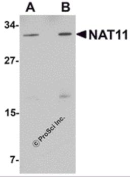 Western blot analysis of NAT11 in human thymus tissue lysate with NAT11 antibody at (A) 1 and (B) 2 μg/mL.