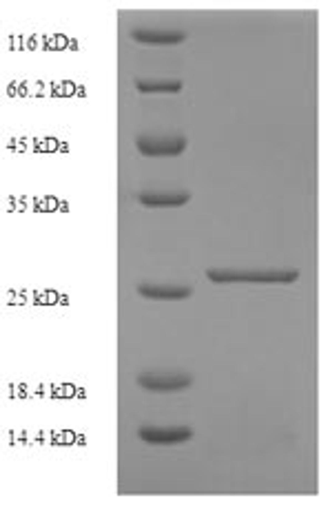 (Tris-Glycine gel) Discontinuous SDS-PAGE (reduced) with 5% enrichment gel and 15% separation gel.