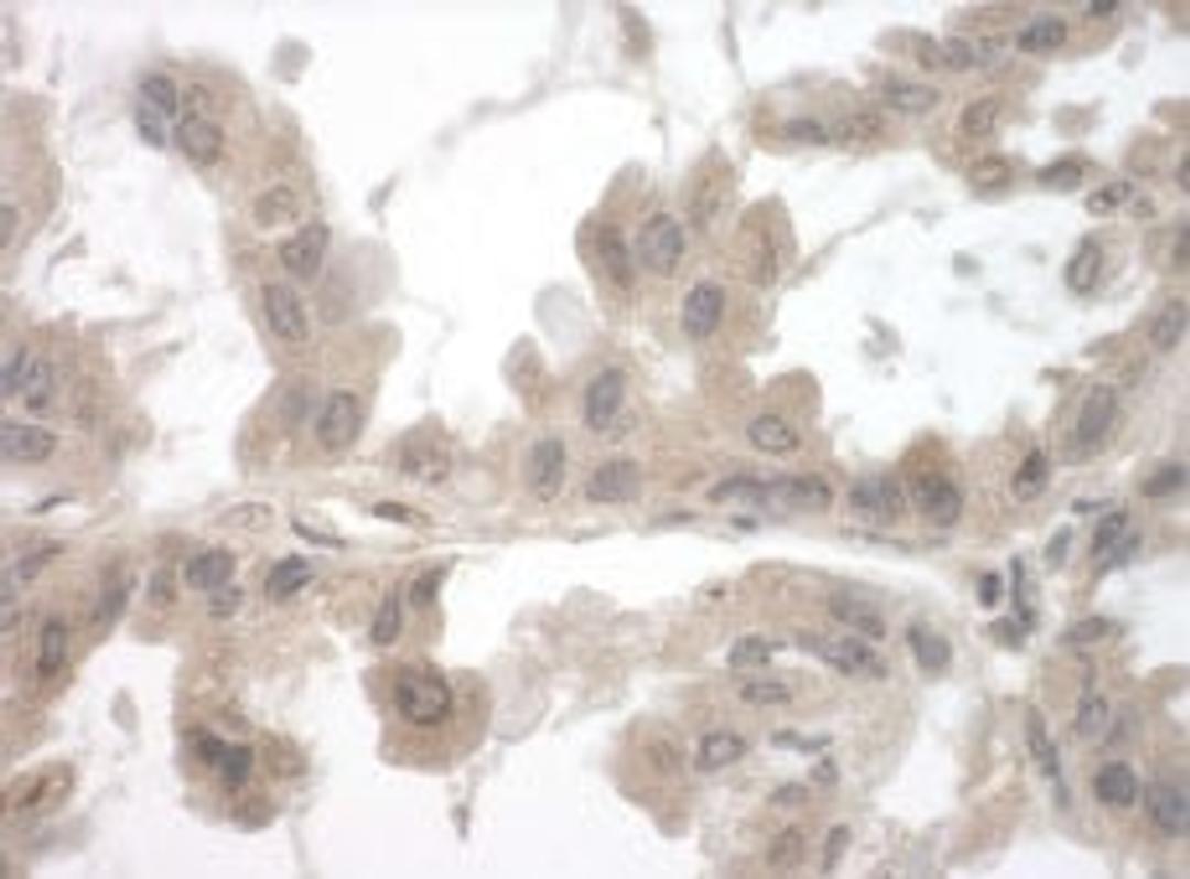 Detection of human Toca-1 by immunohistochemistry.