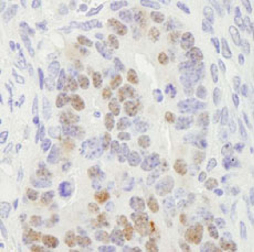 Detection of mouse RCC2 by immunohistochemistry.