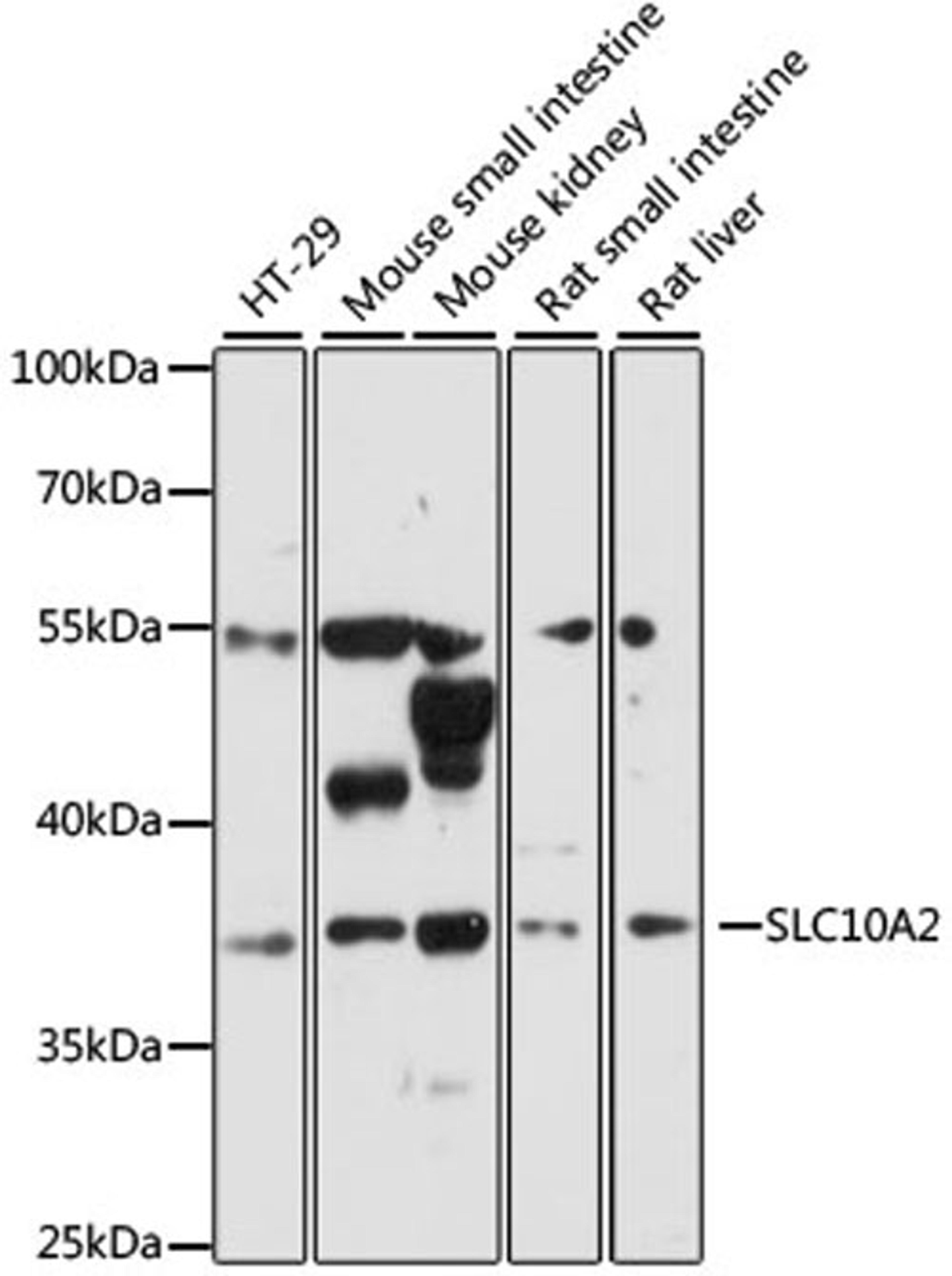 Western blot - SLC10A2 antibody (A12846)