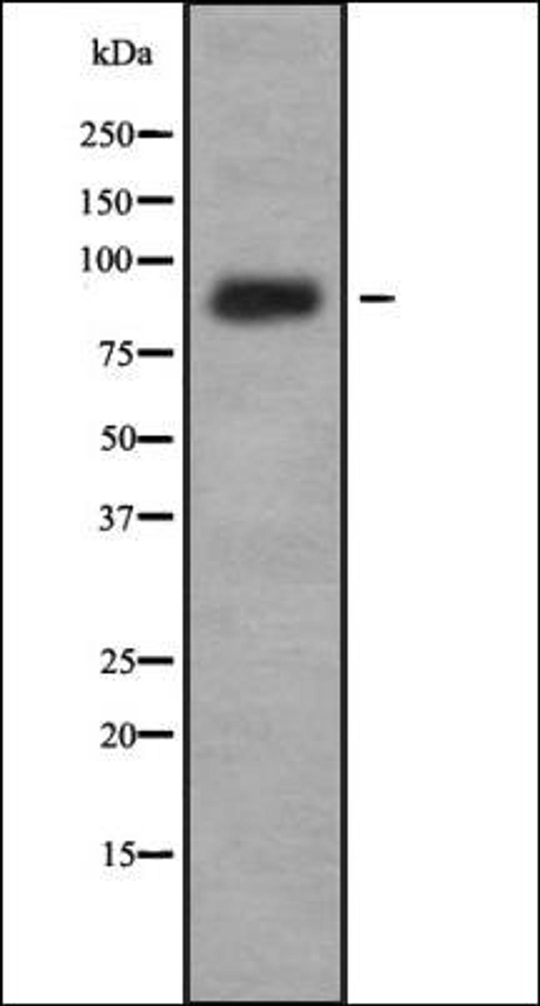 Western blot analysis of K562 whole cell lysates using IL-4R alpha antibody