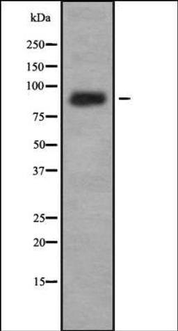 Western blot analysis of K562 whole cell lysates using IL-4R alpha antibody