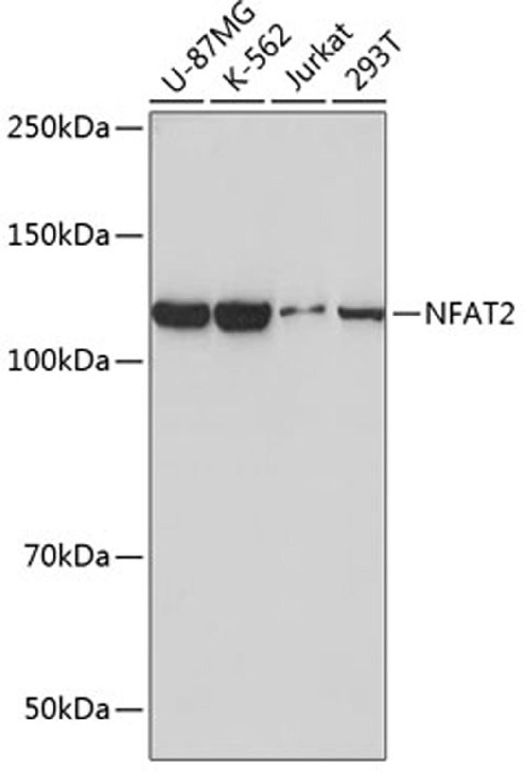 Western blot - NFAT2 antibody (A19597)