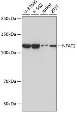 Western blot - NFAT2 antibody (A19597)