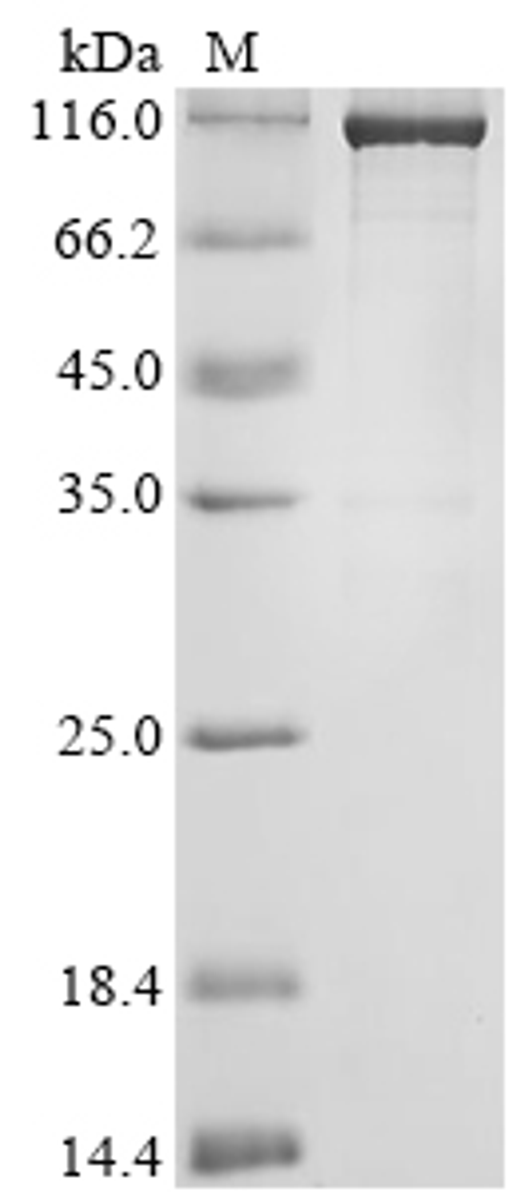 (Tris-Glycine gel) Discontinuous SDS-PAGE (reduced) with 5% enrichment gel and 15% separation gel.