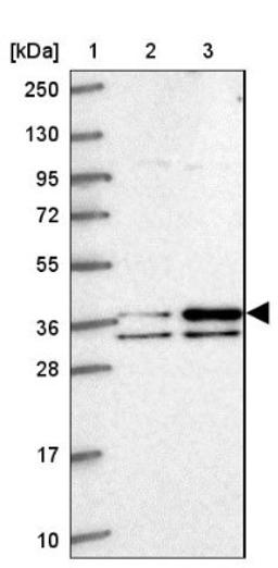 Western Blot: PPAPDC1A Antibody [NBP2-14545] - Lane 1: Marker [kDa] 250, 130, 95, 72, 55, 36, 28, 17, 10<br/>Lane 2: Human cell line RT-4<br/>Lane 3: Human cell line U-251MG sp