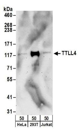 Detection of human TTLL4 by WB.