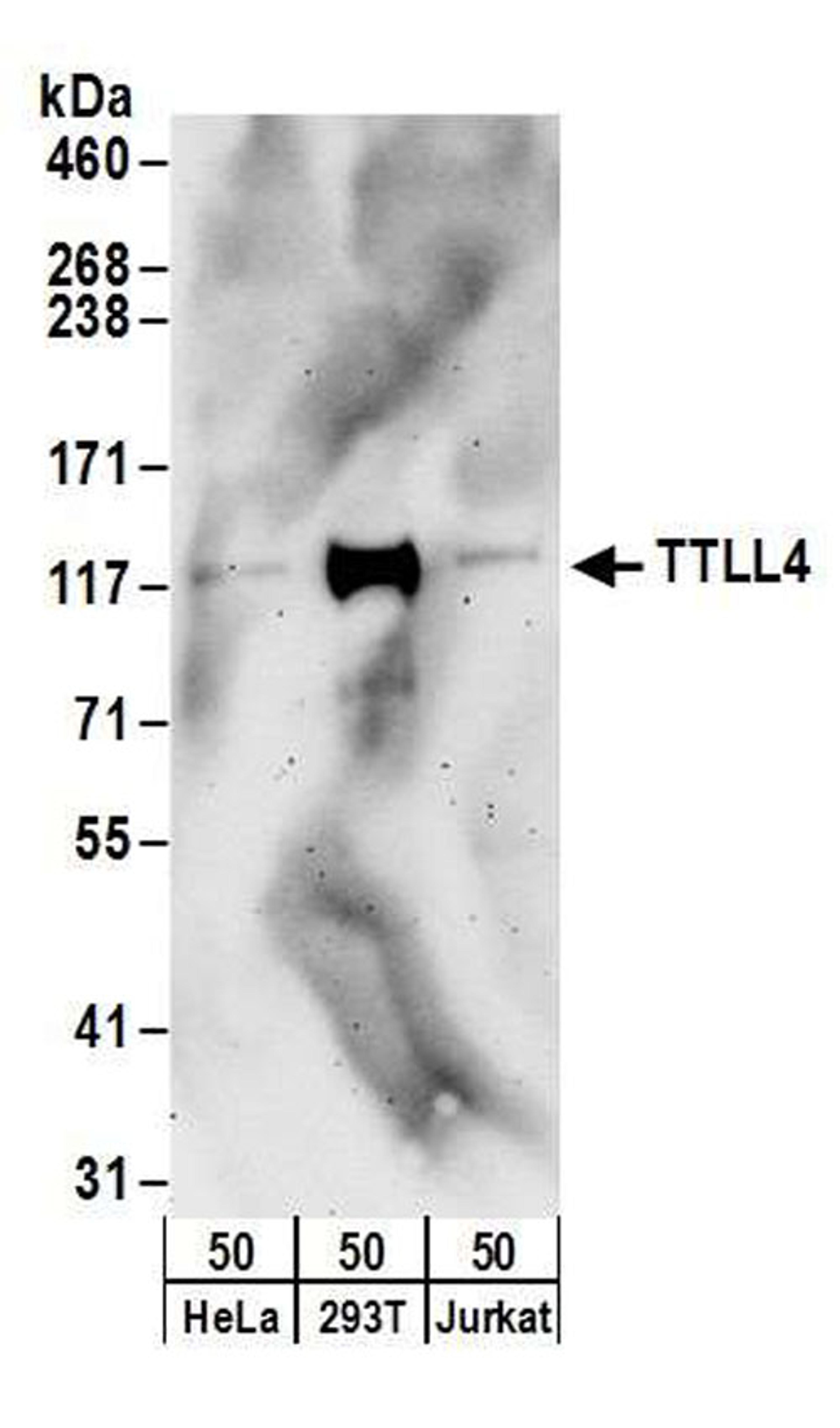 Detection of human TTLL4 by WB.