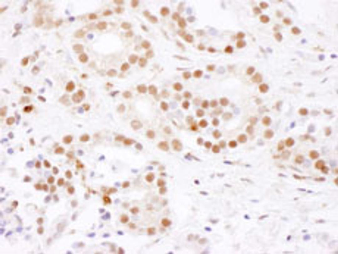 Detection of human SF3B4 by immunohistochemistry.