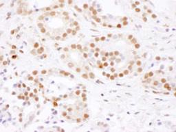 Detection of human SF3B4 by immunohistochemistry.