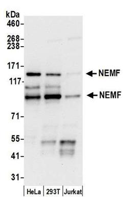 Detection of human NEMF by WB.