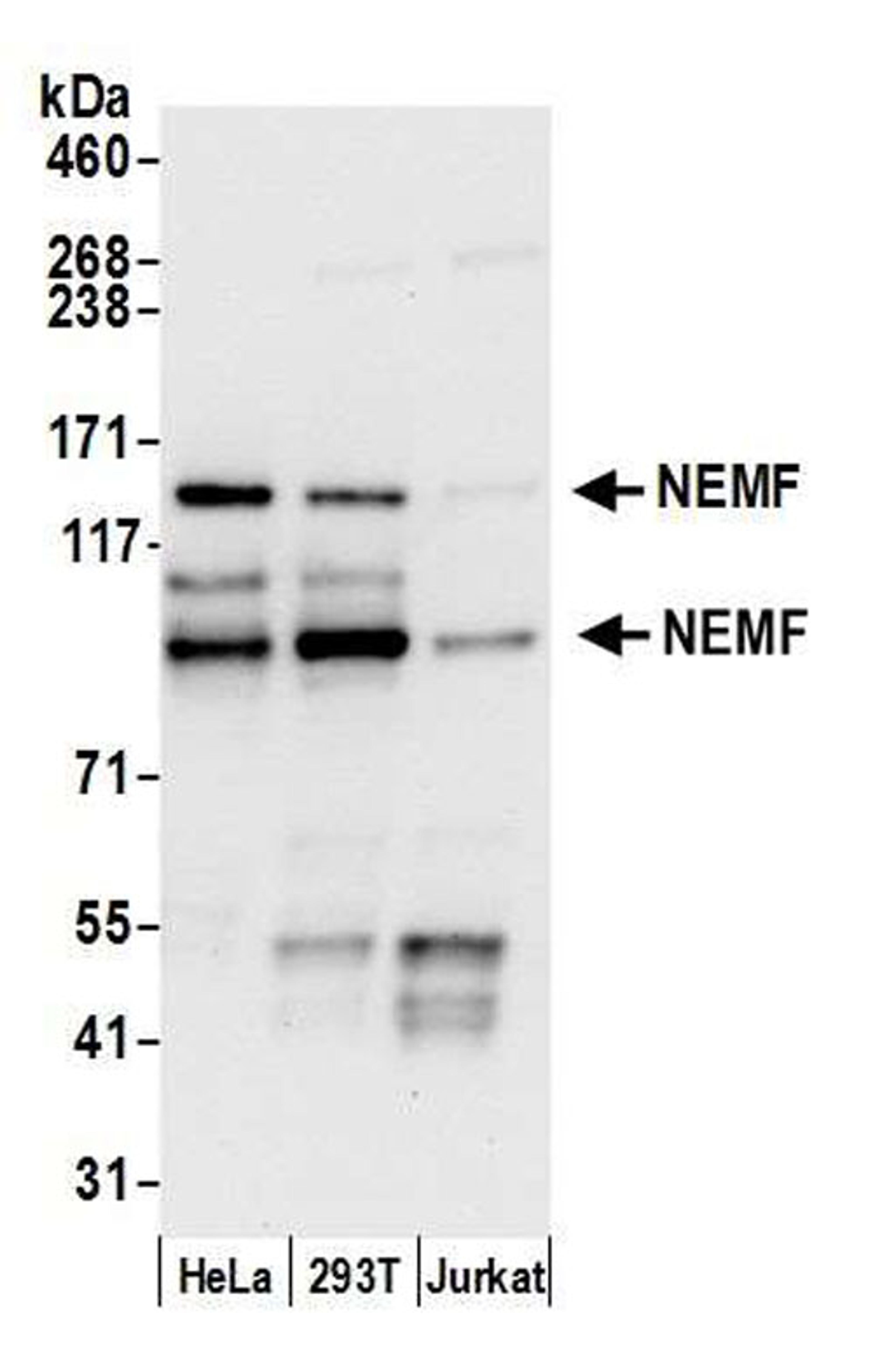 Detection of human NEMF by WB.