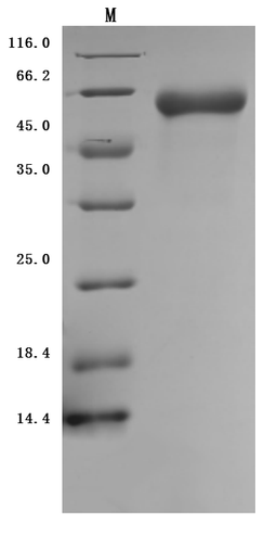 (Tris-Glycine gel) Discontinuous SDS-PAGE (reduced) with 5% enrichment gel and 15% separation gel.
