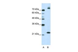 Antibody used in WB on Human Jurkat 2.5 ug/ml.