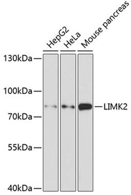 Western blot - LIMK2 antibody (A5409)