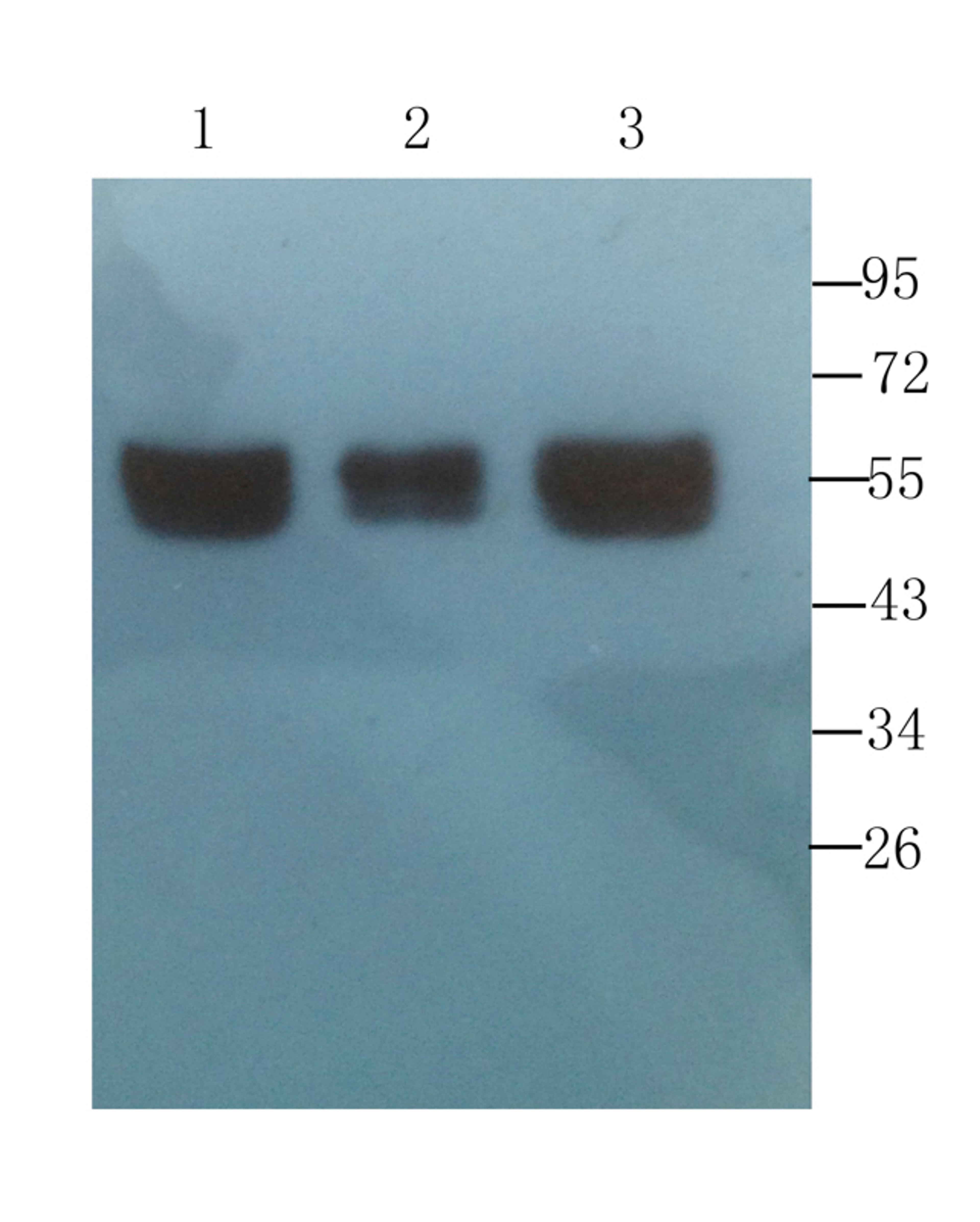 Western blot analysis of  human breast tumor (lane 1), human mammary fibroma (lane 2), human breast cancer (lane 3) using CD4 antibody  (1 ug/ml)