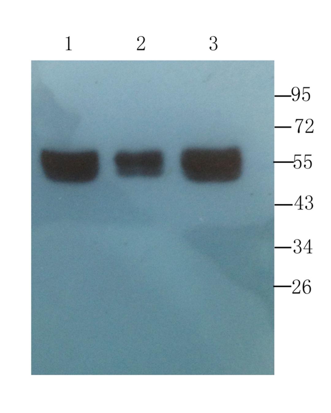 Western blot analysis of human breast tumor (lane 1), human mammary fibroma (lane 2), human breast cancer (lane 3) using CD4 antibody (1 ug/ml)