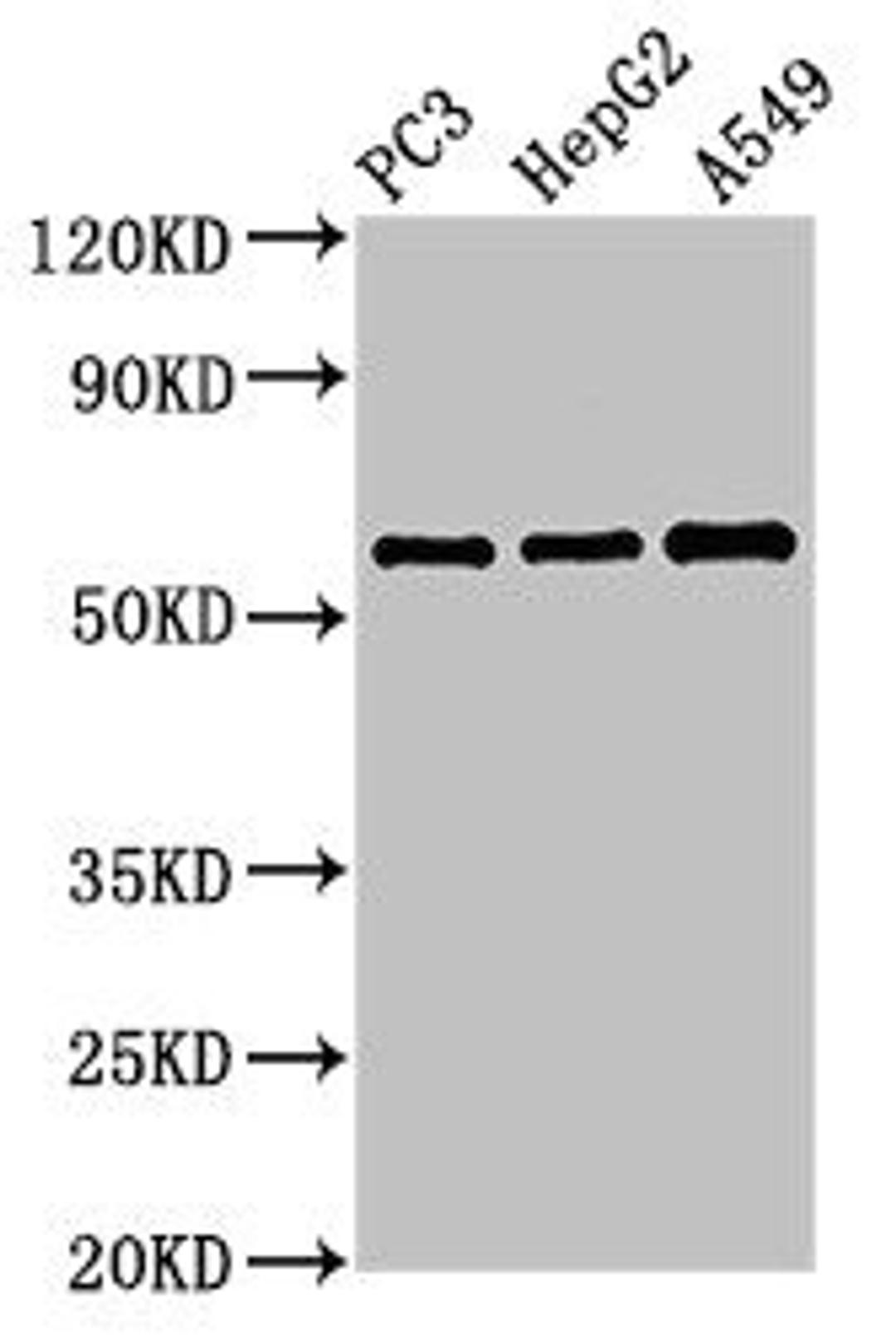 Western Blot. Positive WB detected in: PC-3 whole cell lysate, HepG2 whole cell lysate, A549 whole cell lysate. All lanes: vnn1 antibody at 3.4ug/ml. Secondary. Goat polyclonal to rabbit IgG at 1/50000 dilution. Predicted band size: 58 kDa. Observed band size: 58 kDa.