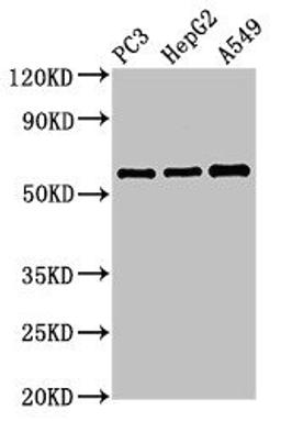 Western Blot. Positive WB detected in: PC-3 whole cell lysate, HepG2 whole cell lysate, A549 whole cell lysate. All lanes: vnn1 antibody at 3.4ug/ml. Secondary. Goat polyclonal to rabbit IgG at 1/50000 dilution. Predicted band size: 58 kDa. Observed band size: 58 kDa.