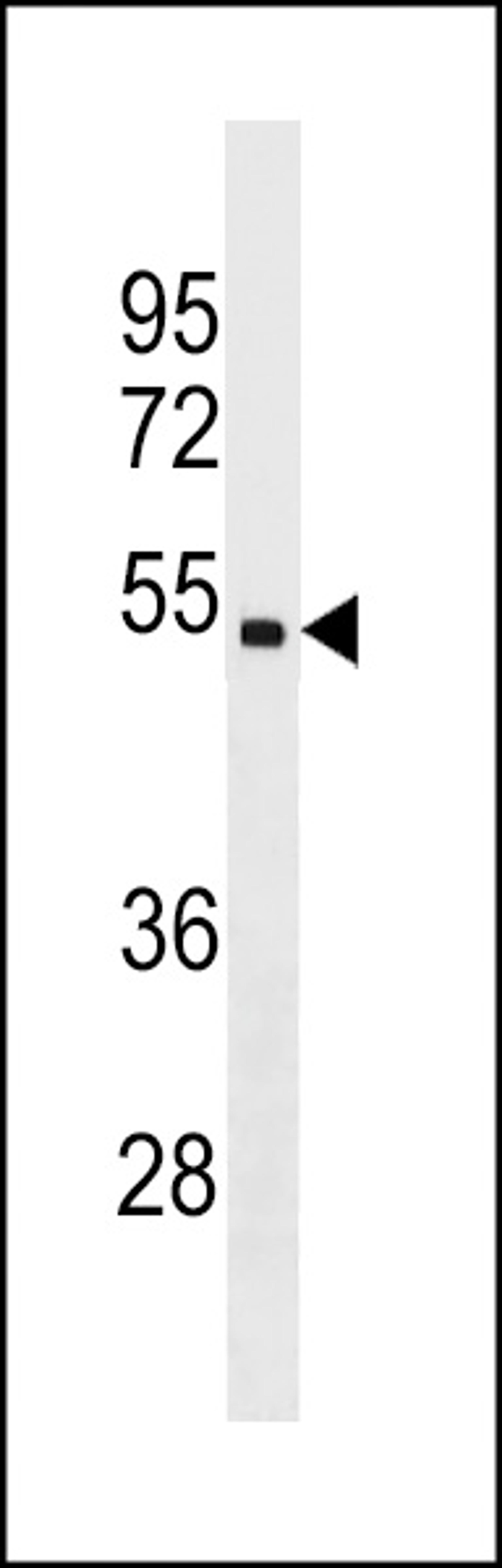 Western blot analysis in ZR-75-1 cell line lysates (35ug/lane).