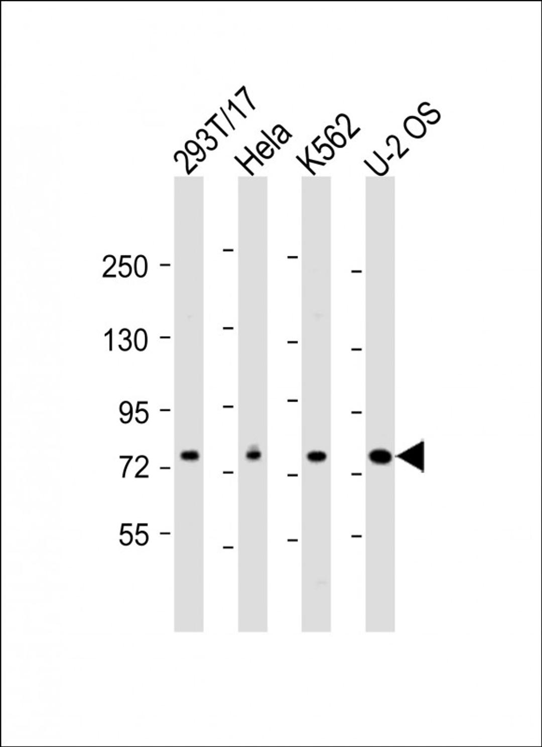 Western Blot at 1:2000 dilution Lane 1: 293T/17 whole cell lysate Lane 2: Hela whole cell lysate Lane 3: K562 whole cell lysate Lane 4: U-2 OS whole cell lysate Lysates/proteins at 20 ug per lane.